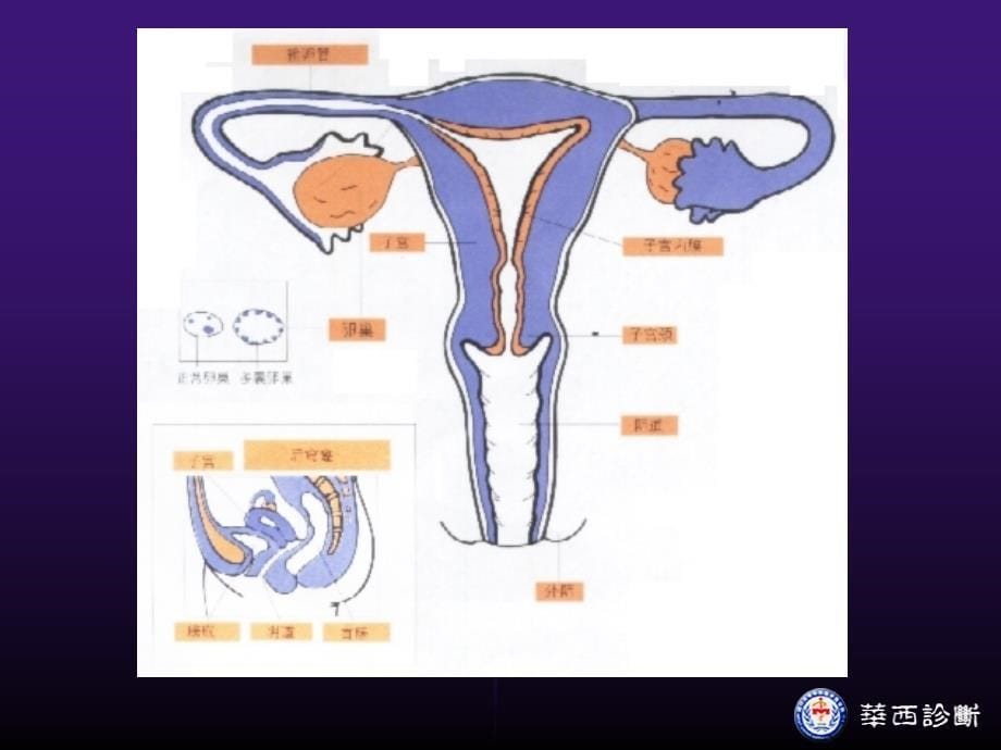 女性生殖器检查相关知识PPT_第5页