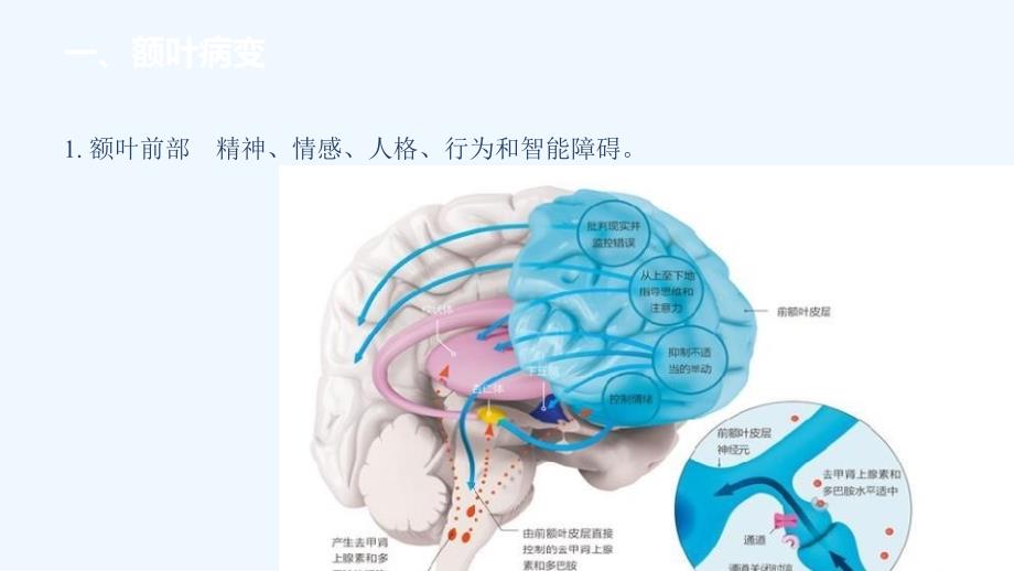 颅脑病变的定位诊断基础和临床图文_第4页