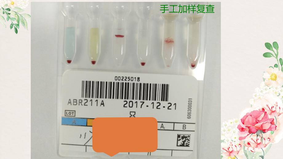 一例ABO血型反应格局的思考_第4页