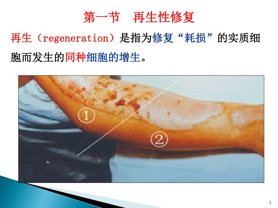 病理学 第三章 再生与修复_第3页