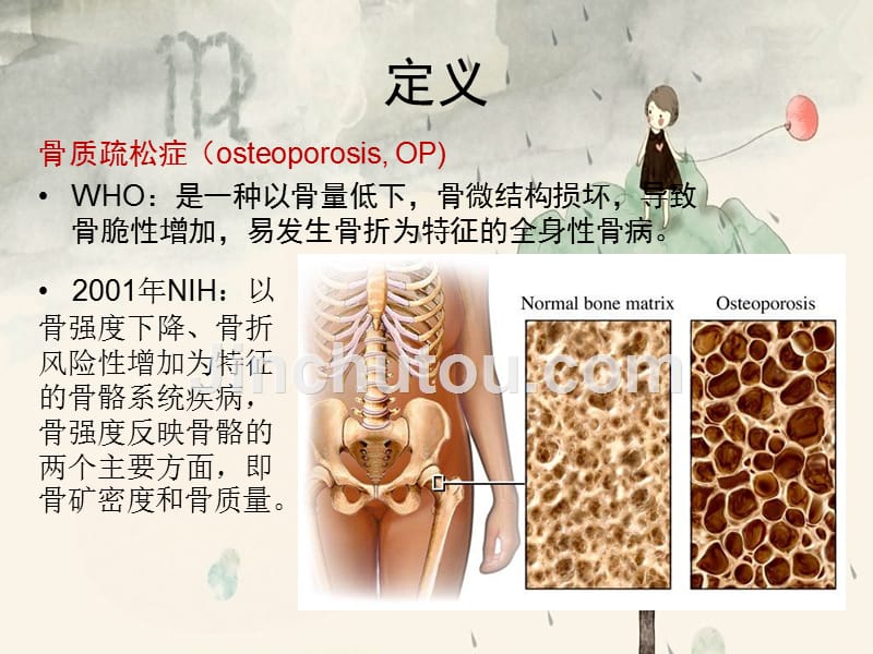 老年科原发性骨质疏松症诊治方式指南_第2页