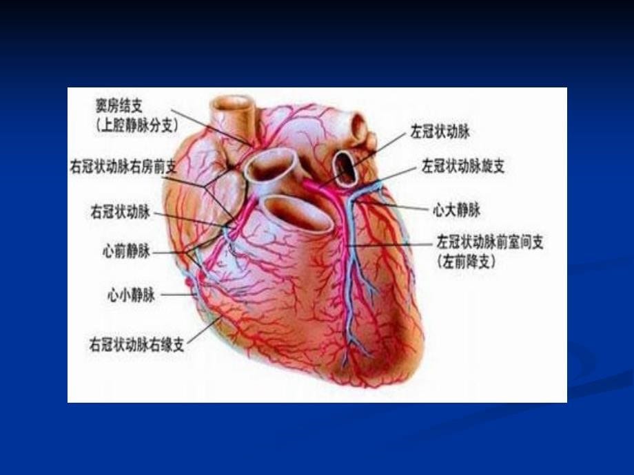 合并冠心病患者非心脏手术麻醉_第5页