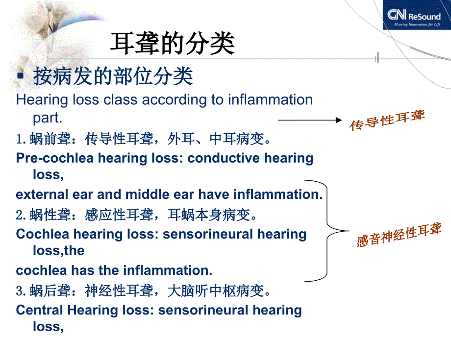 耳聋相关疾病和听力图分析讲座_第4页