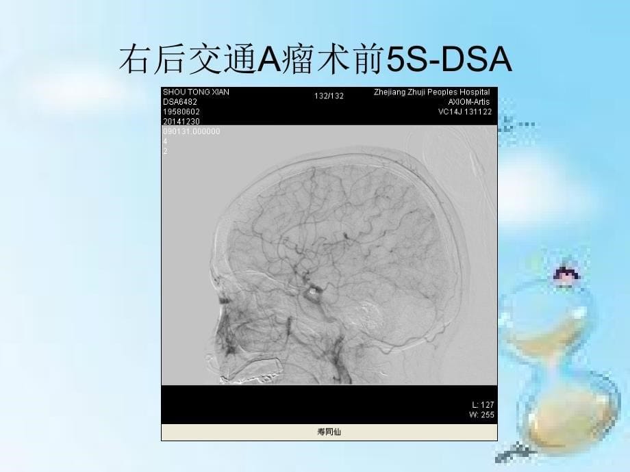 Dyna_CT的临床应用_第5页