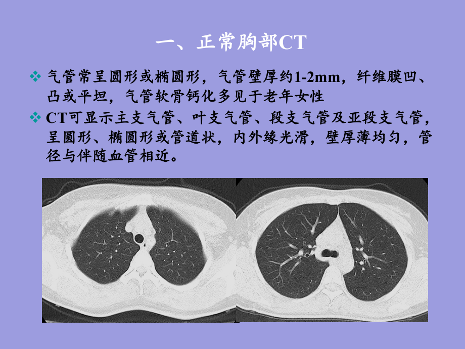 胸部CT下基本解剖与胸部一般病变_第2页