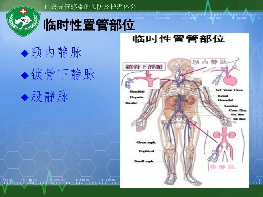 血透导管感染预防及医院护理_第5页