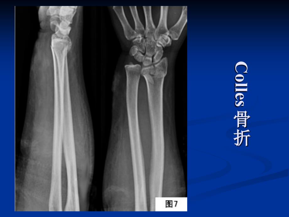 X光片(总结)-医学资料_第2页