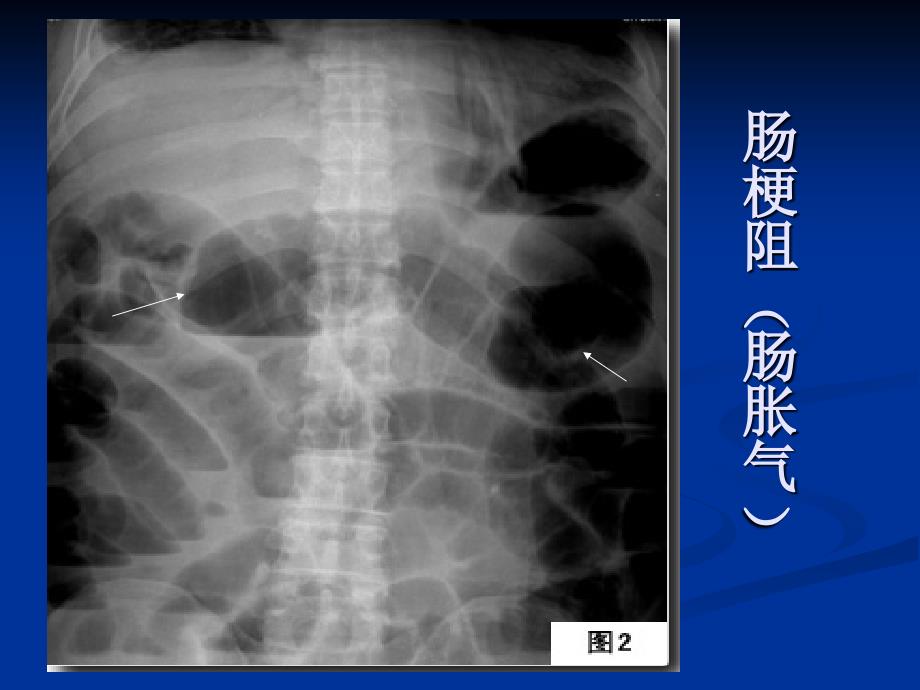 X光片(总结)-医学资料_第3页