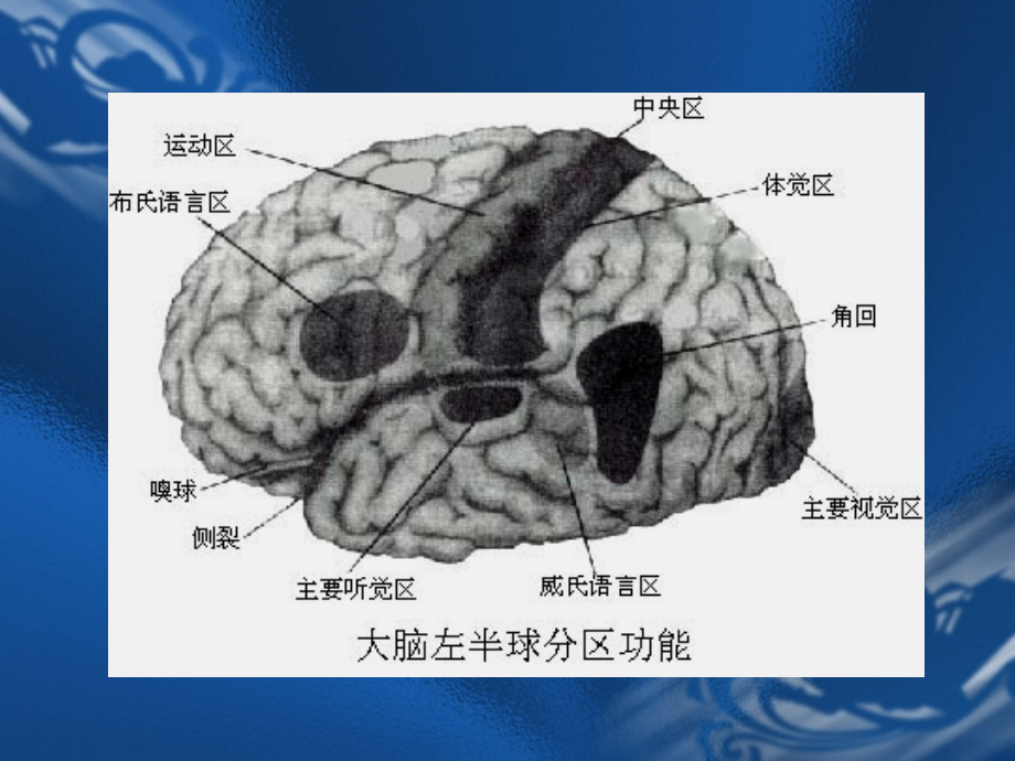 MRI解剖—颅脑-医学资料_第2页