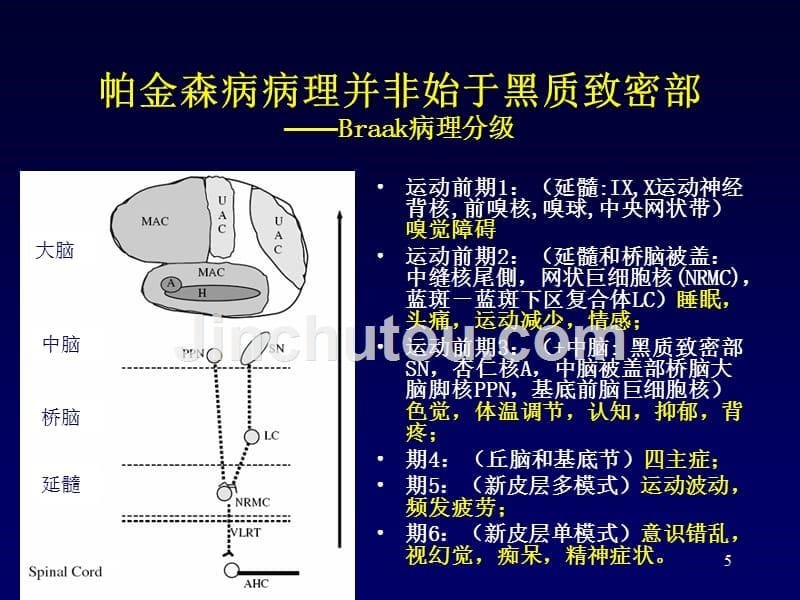 PD诊断治疗-医学资料_第5页