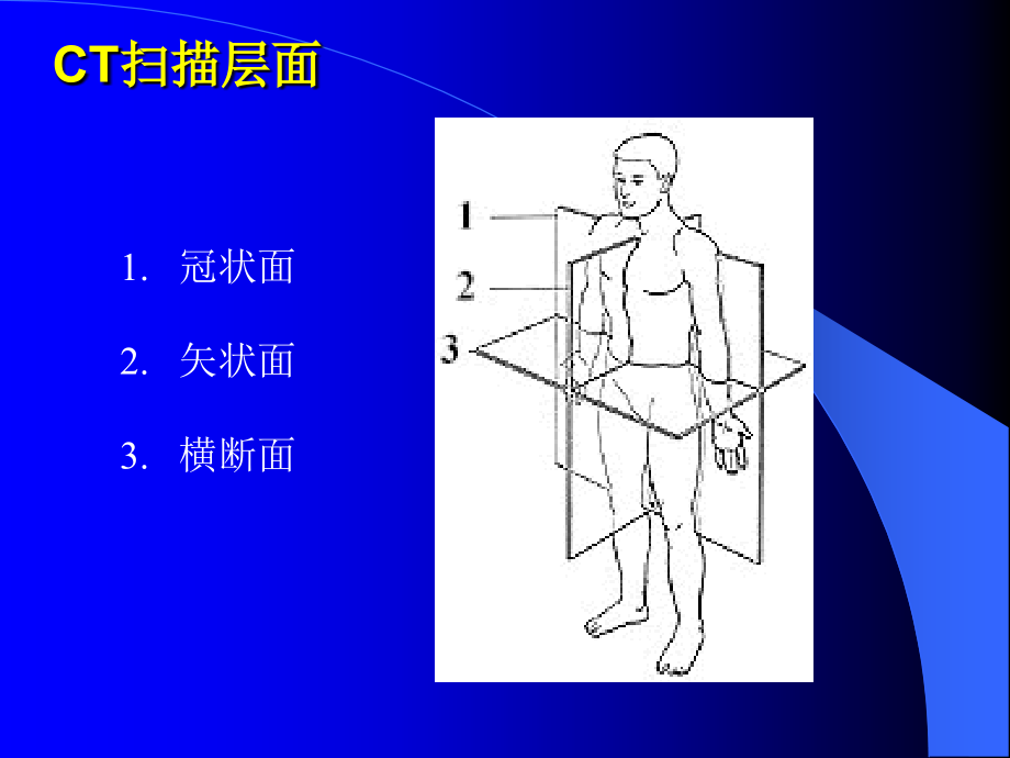 CT应用-脑-医学资料_第4页