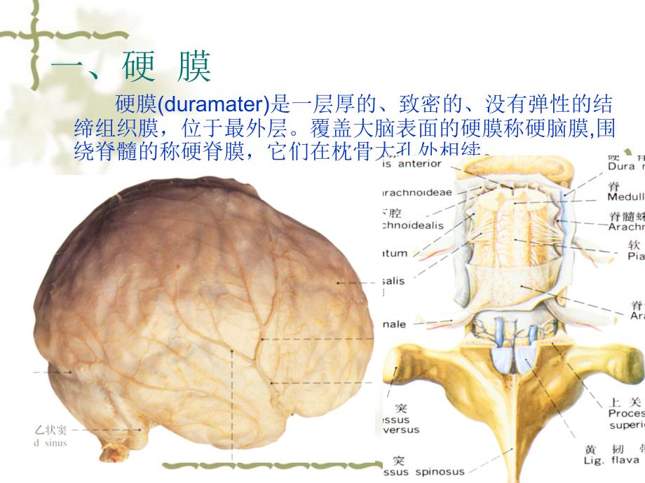 J脑和脊髓的被膜2-医学资料_第3页