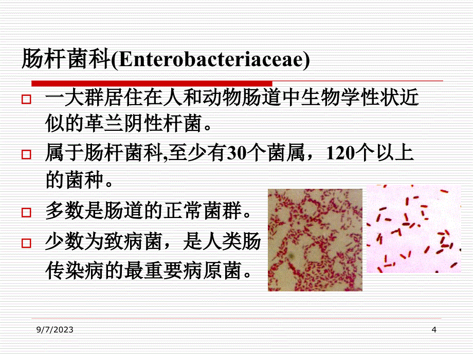 第10章1肠杆菌科-医学资料_第4页