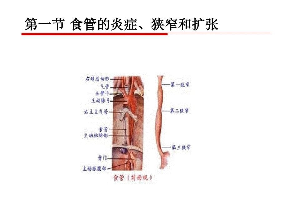 病理第8版课件-消化系统疾病-医学资料_第5页