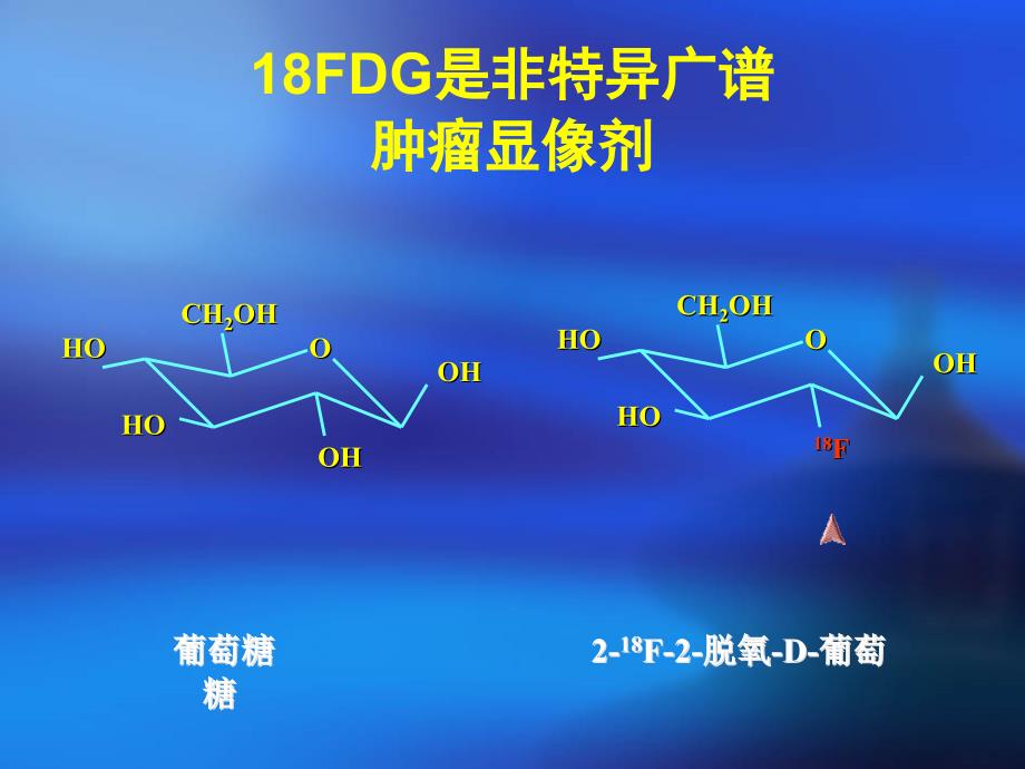 FDG-PET非肿瘤摄取-医学资料_第2页