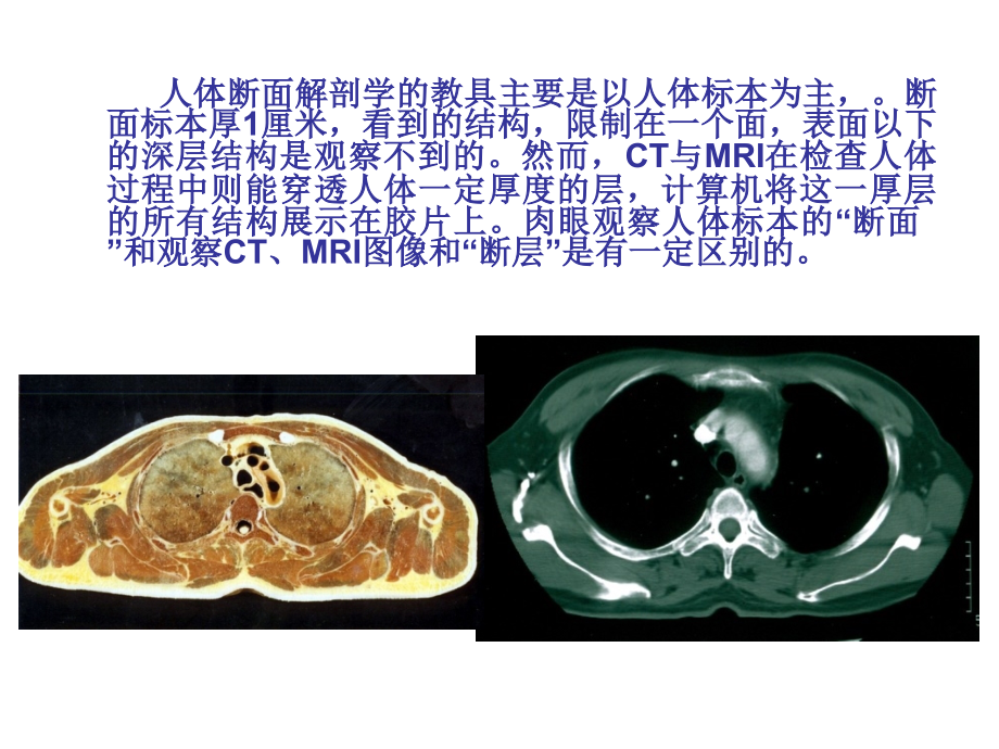 04 纵隔连续横断层解剖修改_第3页