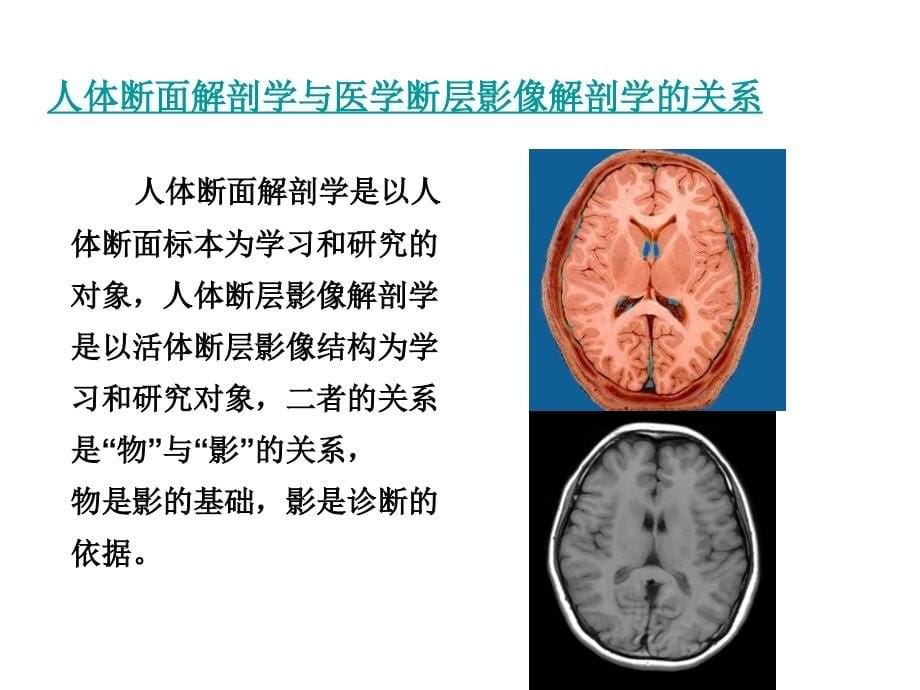 04 纵隔连续横断层解剖修改_第5页