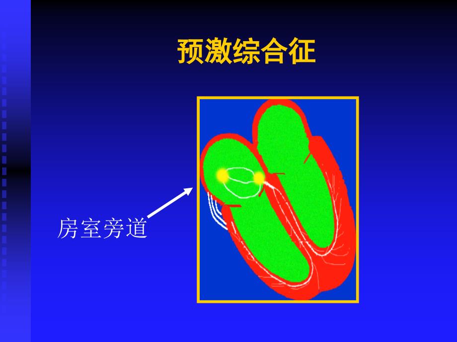 第五部分心律失常_第3页