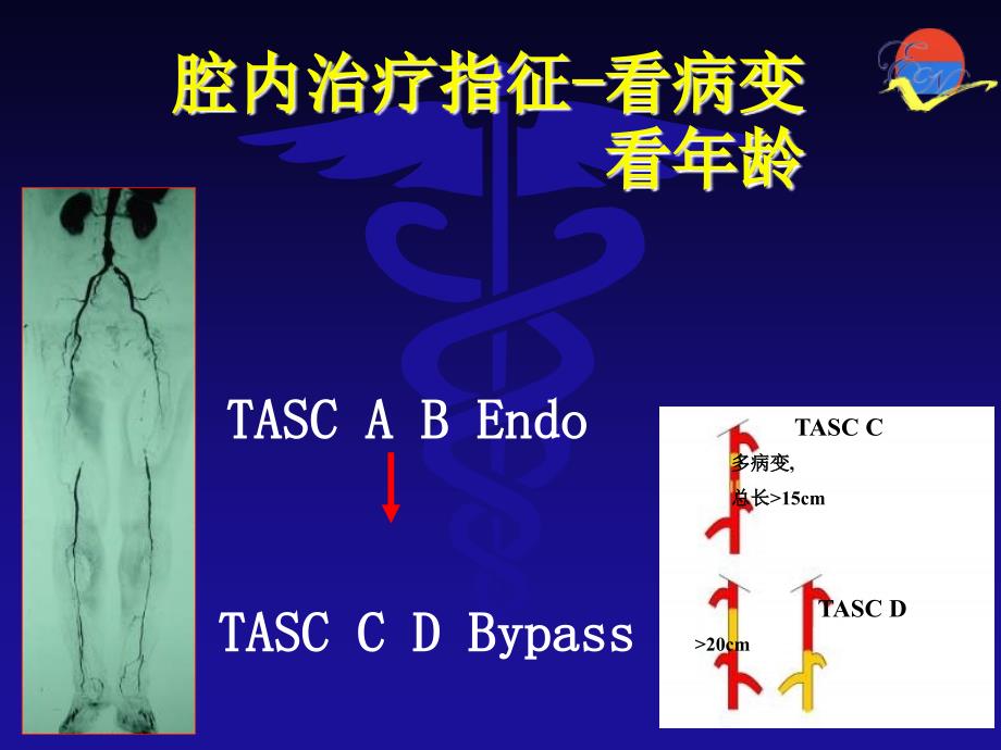 股浅动脉CTO的腔内治疗课件_第4页