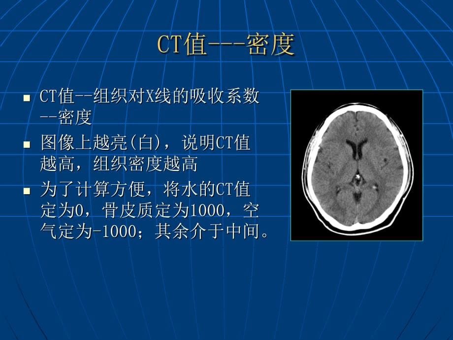 颅脑CT基本影像诊断桑德胜_第5页