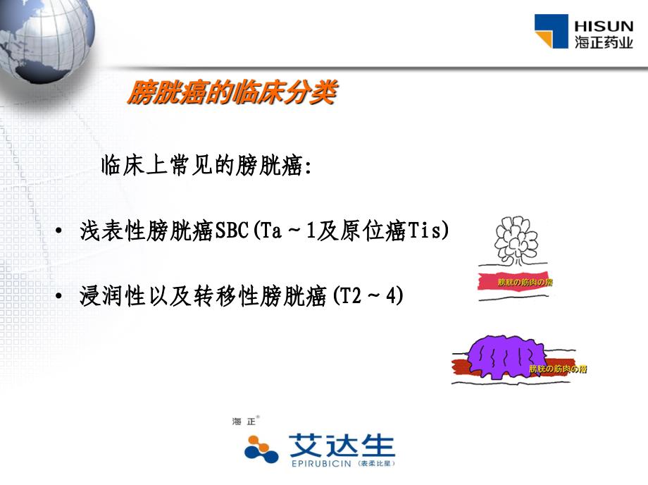 表柔比星膀胱灌注化疗介绍-医学资料_第4页