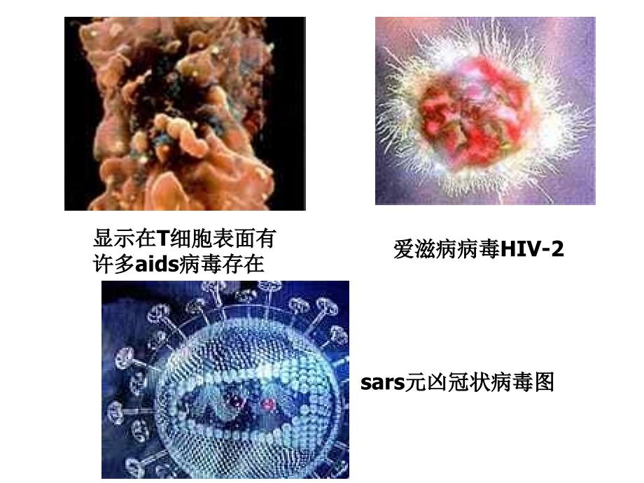 免疫1(1)_第2页