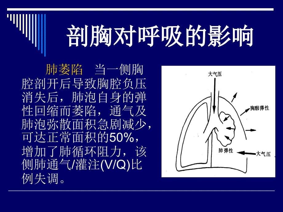 第16章胸科手术的麻醉-医学资料_第5页