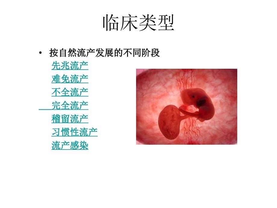 流产_第5页