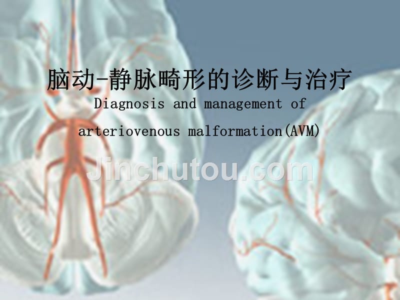 脑动静脉畸形的诊治PPT课件123_第1页