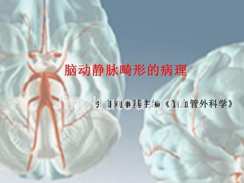 脑动静脉畸形的诊治PPT课件123_第5页