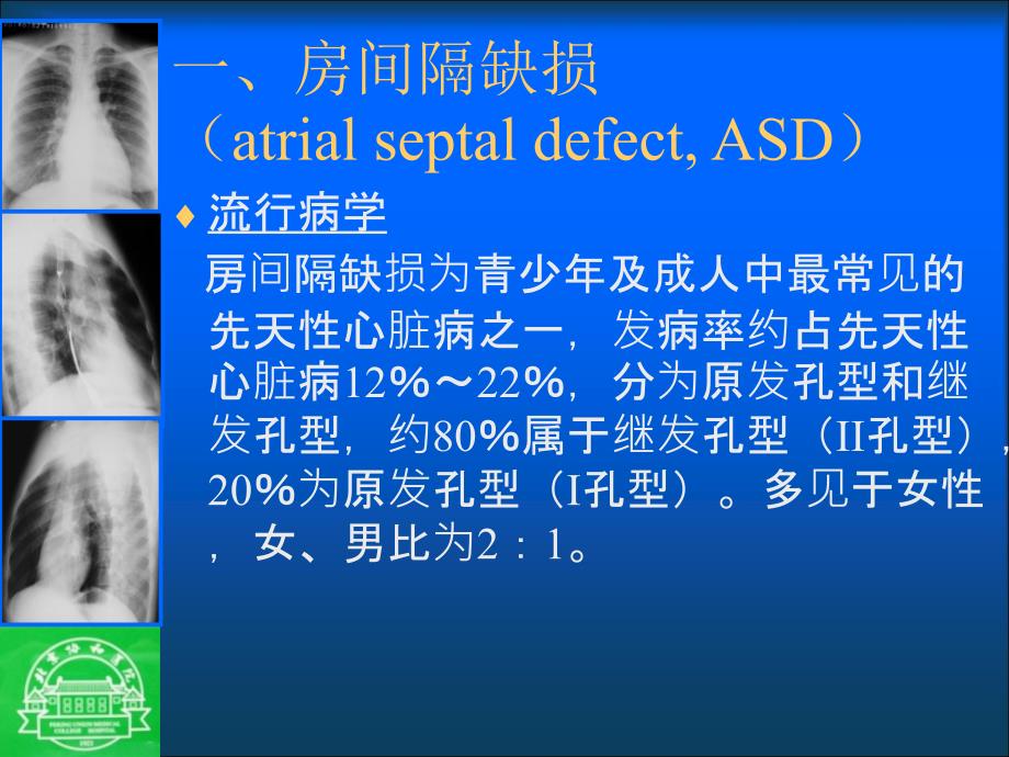 【影像学】_先心病和风心病-北京协和医院学习_第3页