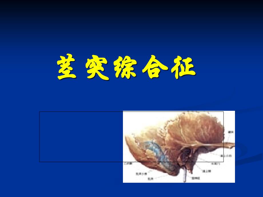 茎突过长__茎突综合征__-_第1页