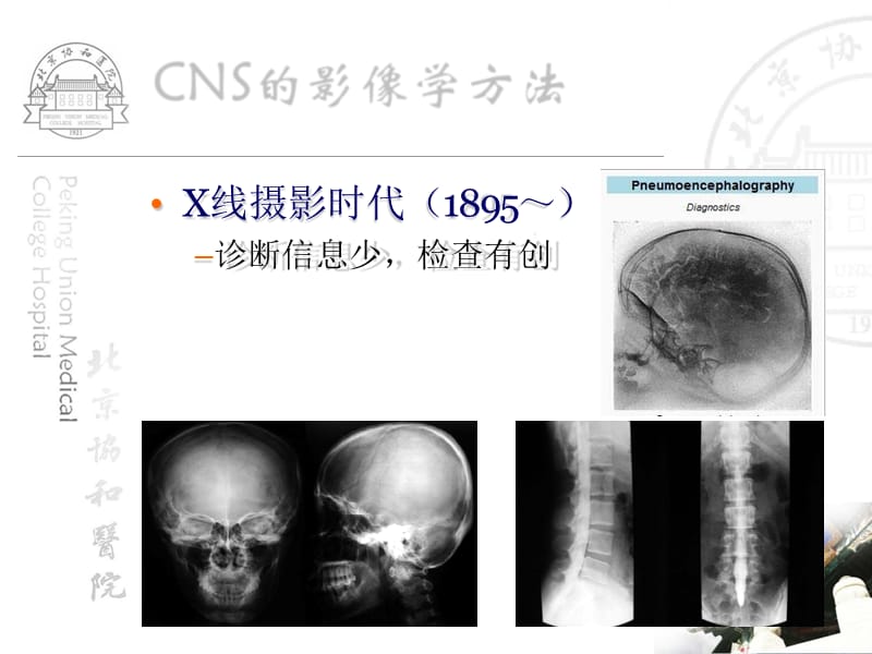 【影像学】_中枢神经系统正常影像学-北京协和医院学习_第4页