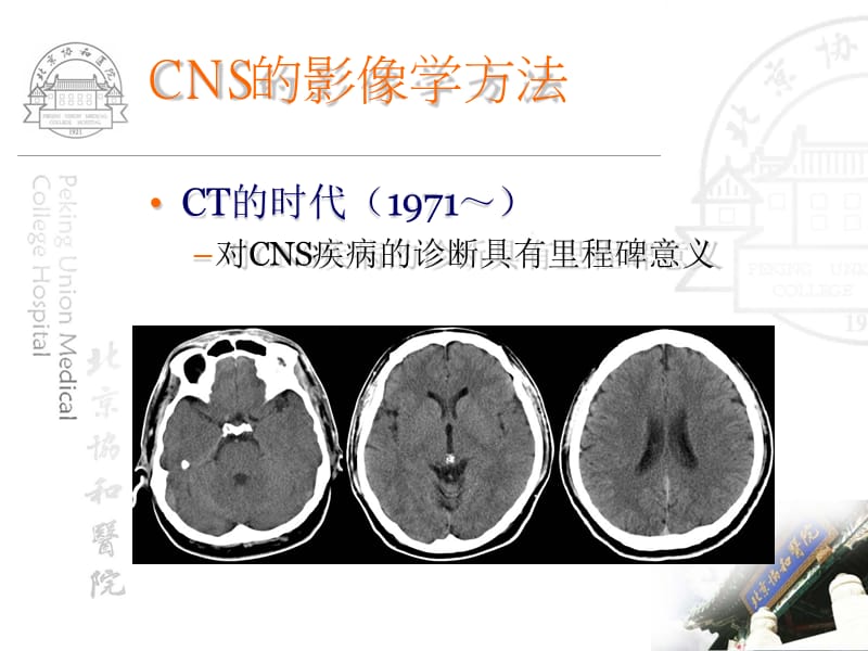 【影像学】_中枢神经系统正常影像学-北京协和医院学习_第5页