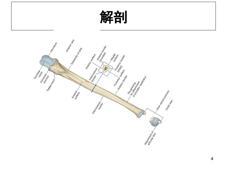 尺骨鹰嘴骨折课件课件_第4页