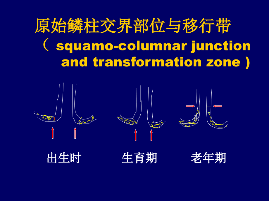 子宫颈上皮内瘤变(CIN)和子宫颈癌_第4页