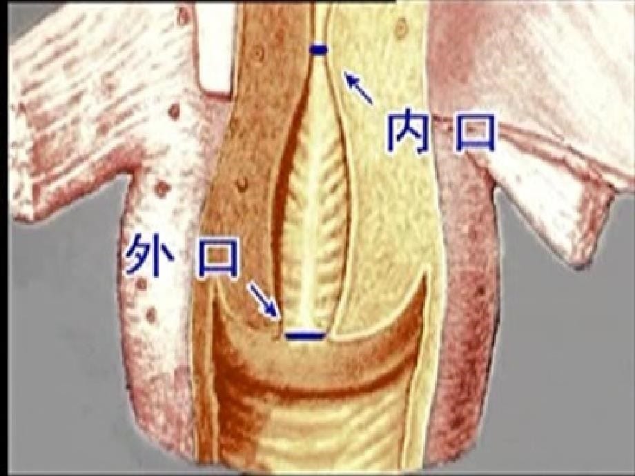 子宫颈上皮内瘤变(CIN)和子宫颈癌_第5页