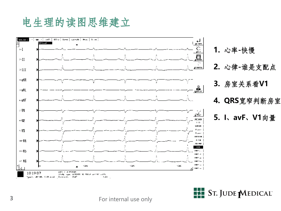 阵发性室上性心动过速最新版本_第3页