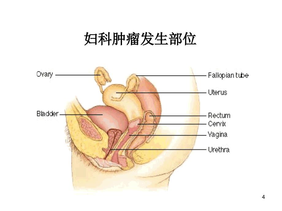 《妇科肿瘤总论》精选PPT幻灯片_第4页