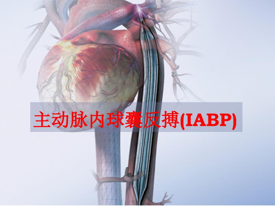 主动脉内球囊反搏(IABP)课件_第1页