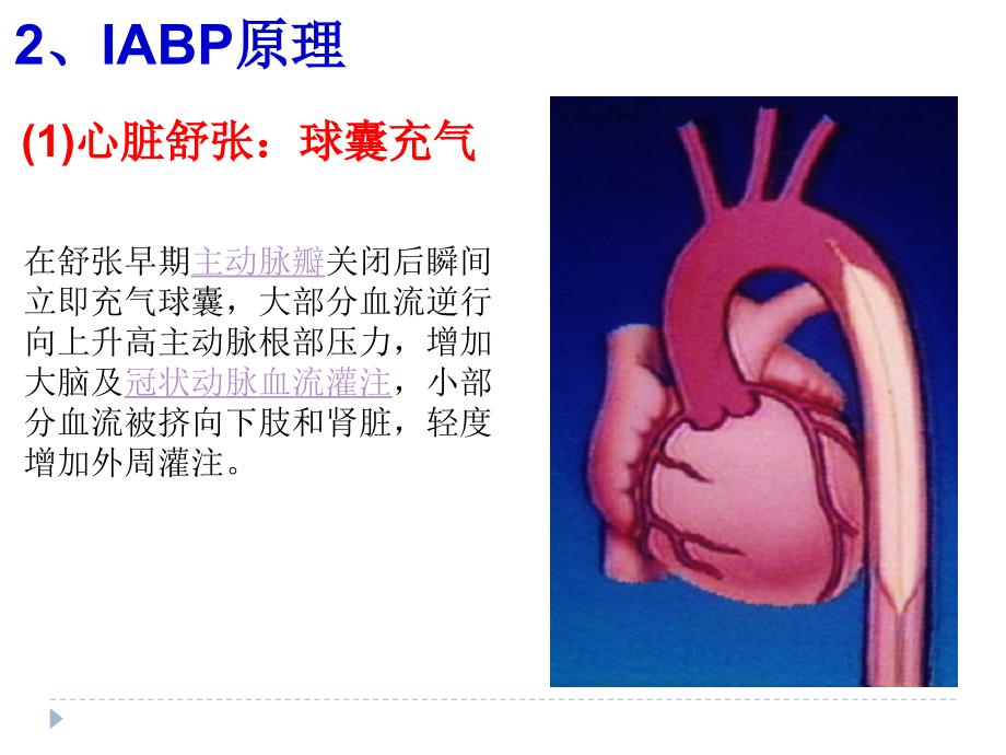 主动脉内球囊反搏(IABP)课件_第4页