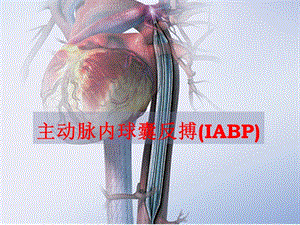 主动脉内球囊反搏(IABP)课件