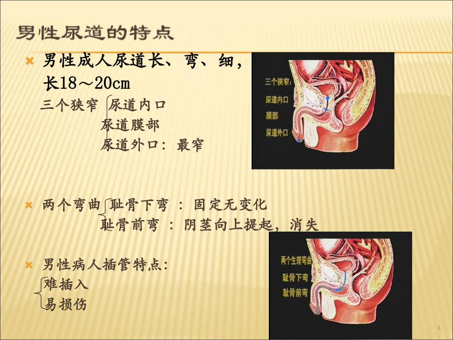 《留置导尿技术操作》PPT幻灯片_第4页