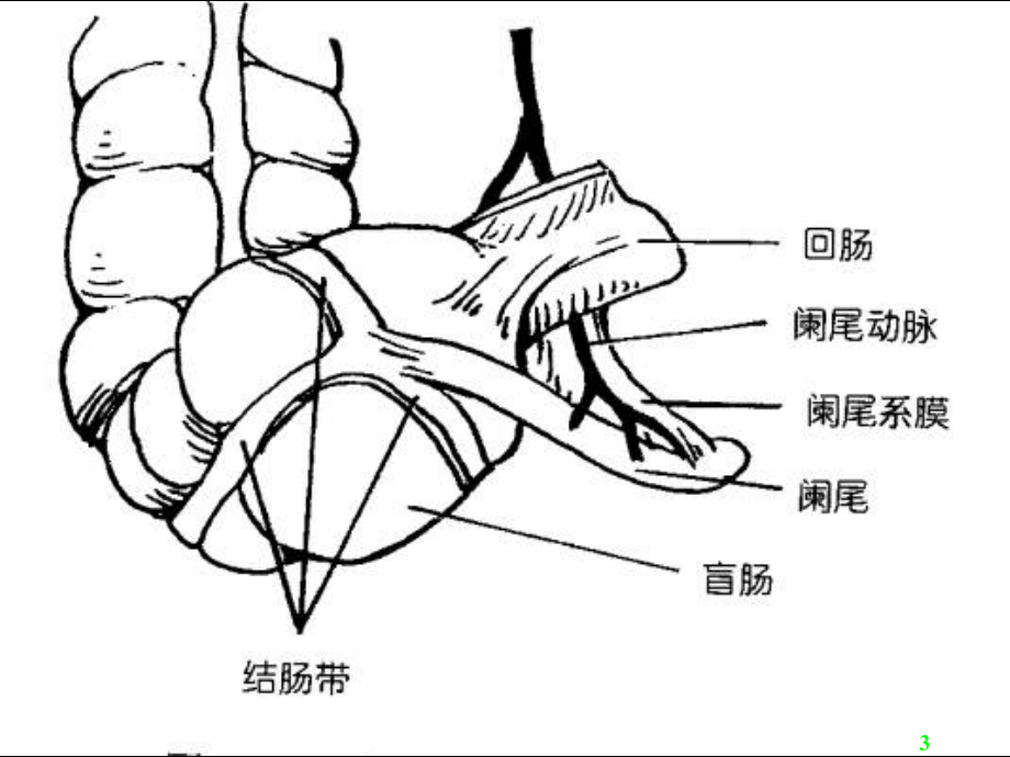 急性阑尾炎一点通演示课件_第3页