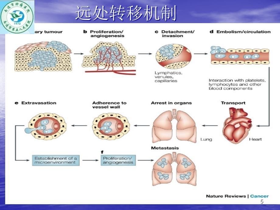 再谈肿瘤外科的无瘤技术和原则PPT幻灯片_第5页