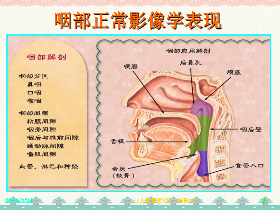 儿童腺样体肥大影像表现及诊断标准编订_第2页