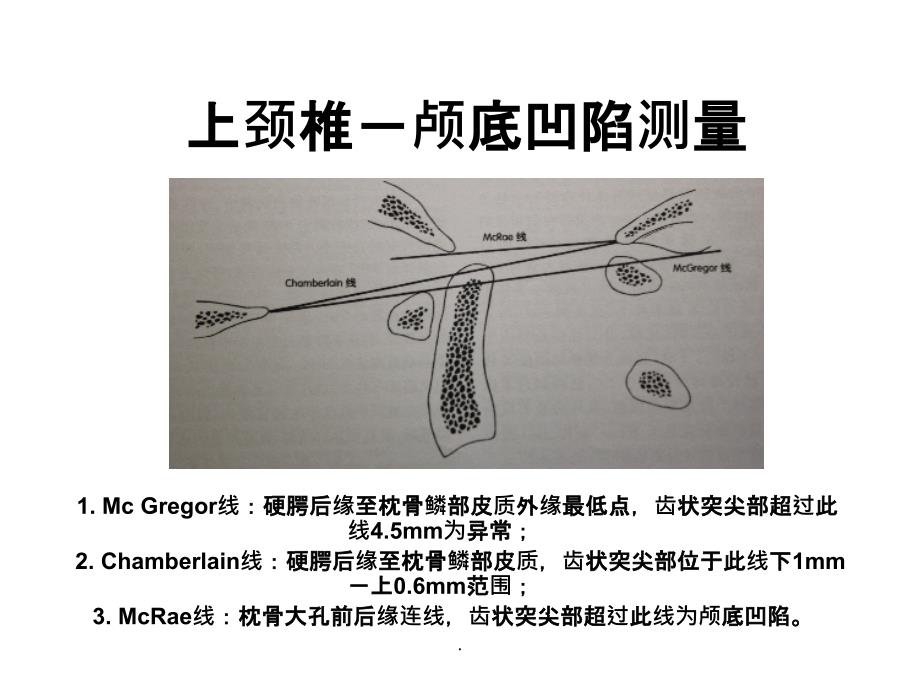 脊柱X线测量最新版本_第3页