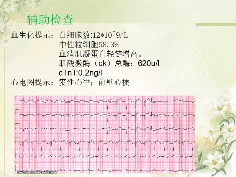 心肌梗死患者急救护理幻灯片课件_第4页