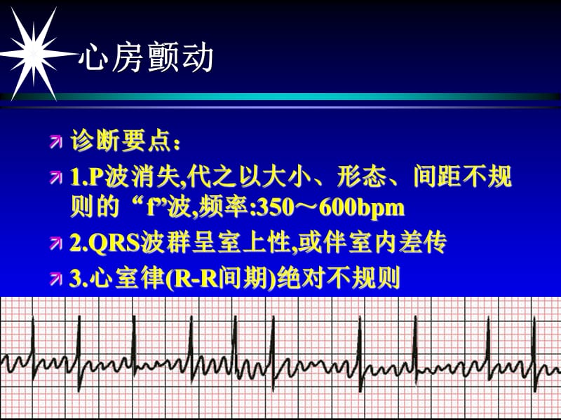 急救培训(心电图)幻灯片课件_第5页