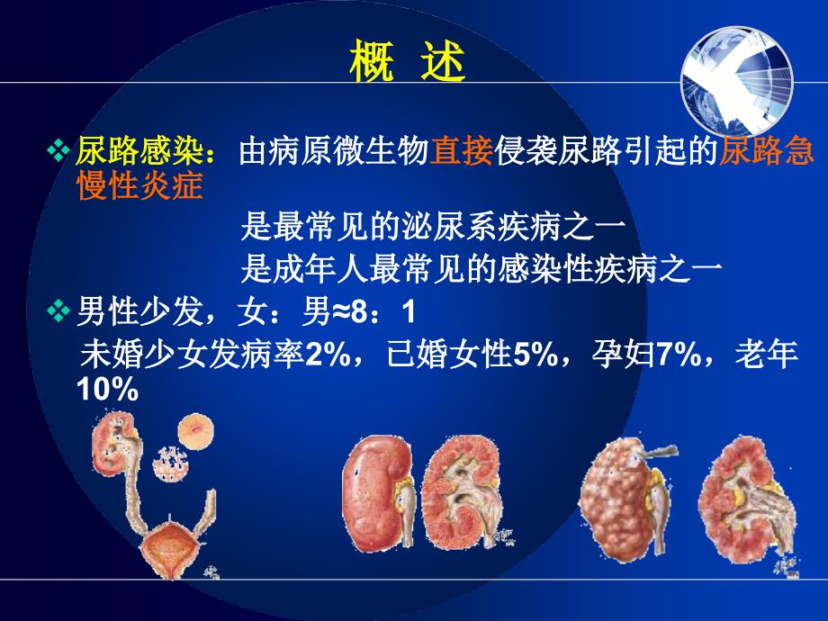 尿路感染病人的护理幻灯片课件_第3页